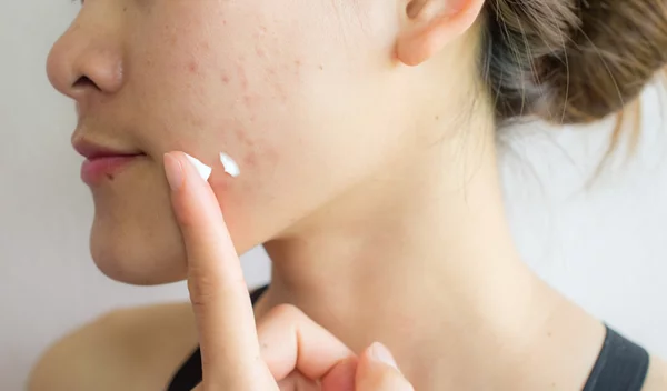 Σε ποια γνωστά καλλυντικά προϊόντα βρέθηκαν υψηλά επίπεδα καρκινογόνων χημικών;