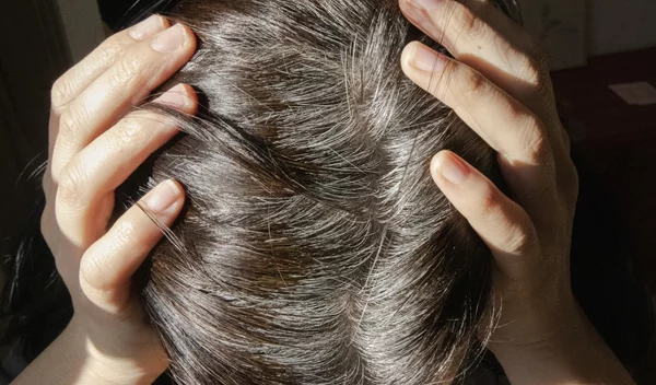 "Ασπρίζουν τα μαλλιά μου": Αξίζει να τα βάψεις (και όχι να τα αποδεχτείς);