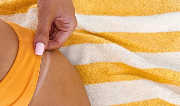 Μανικιούρ: 6 αποχρώσεις που "γράφουν" τέλεια στη μαυρισμένη επιδερμίδα