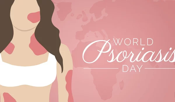 Ψωρίαση: Όλες οι εξελίξεις στη θεραπεία