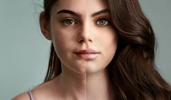 Τι οδηγεί τα κορίτσια παγκοσμίως να διαστρεβλώνουν την εμφάνισή τους στο διαδίκτυο;