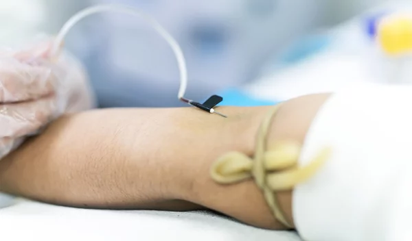 Καρκίνος του παγκρέατος: Πώς μια απλή αιμοληψία μπορεί να δώσει έγκαιρη διάγνωση;