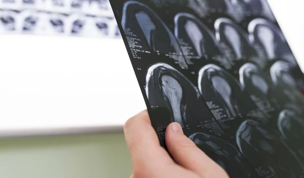 Η σημασία της εξειδίκευσης στην Ορθοπαιδική και το όραμα της Synovus στην Αθήνα