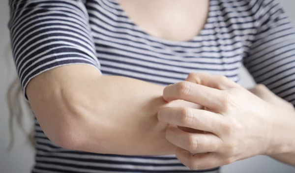 6 τρόφιμα που καταναλώνεις και αυξάνουν τις πιθανότητες να σε τσιμπήσουν τα κουνούπια