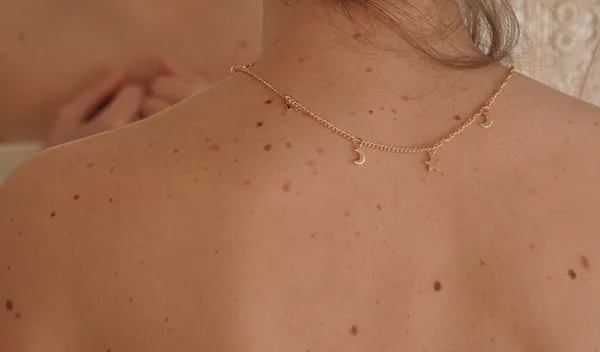 Τι είναι το skin check και γιατί θεωρείται τόσο σημαντικό;