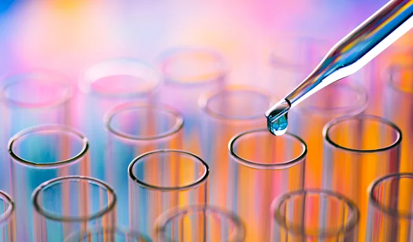 Νέο τεστ ανιχνεύει την Πάρκινσον 7 χρόνια πρoτού εμφανιστεί