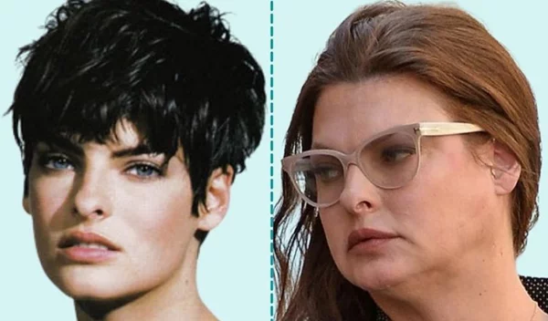 Οι διάσημες κυρίες που παραμορφώθηκαν μετά από πλαστική επέμβαση