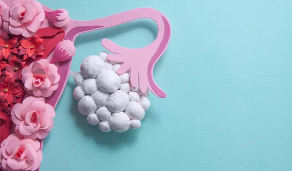 Έχεις πολυκυστικές ωοθήκες; Κάνε αυτό που προτείνει ελληνική έρευνα