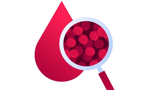 Χαμηλός αιματοκρίτης, έλλειψη βιταμινών; Τι σημαίνουν τα αποτελέσματα από τις εξετάσεις αίματος