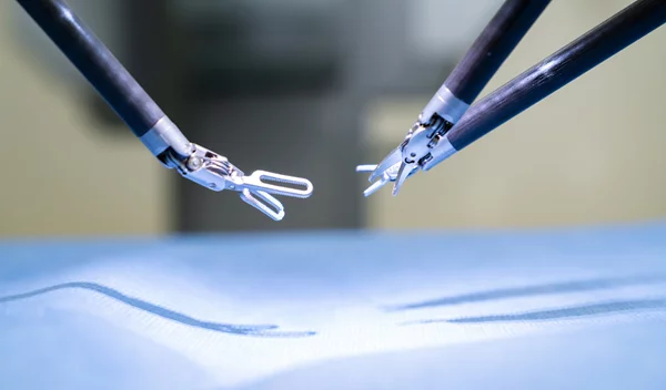 Ευρωκλινική Αθηνών: Πρωτοπορεί στη Ρομποτική Χειρουργική του καρκίνου του παχέος εντέρου με ΑΙ