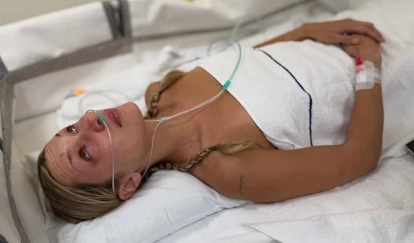 Πώς θα καταλάβεις τη νόσο Lyme; Το πιο χαρακτηριστικό σημάδι που προειδοποιεί