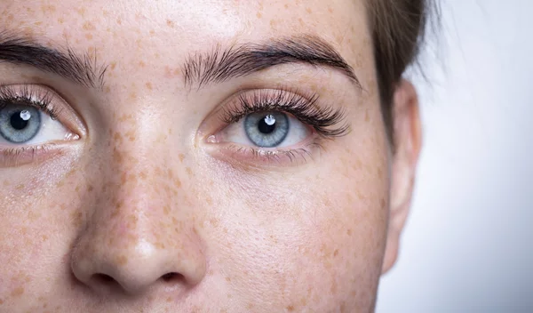 Μαύροι κύκλοι: Η συχνή αιτία που τους προκαλεί και ο εύκολος τρόπος για να τους "εξαφανίσουμε"