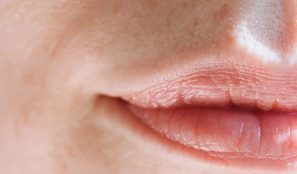 Ρυτίδες γέλιου: Το makeup hack για να τις εξαφανίσεις φυσικά