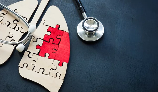 Αφιέρωμα Υγείας: Οι εξελίξεις στη θεραπεία του καρκίνου του πνεύμονα