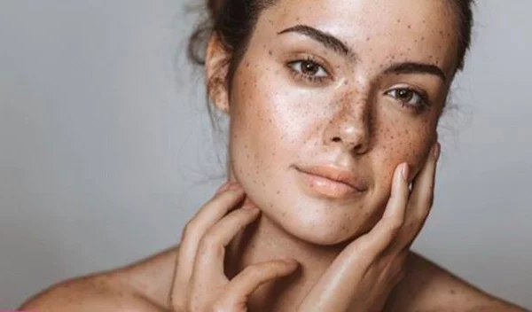 8 απλοί τρόποι για να ενυδατώνεις το πρόσωπό σου εύκολα μέσα στη μέρα