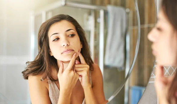 Η ακμή σε έξαρση μετά το καλοκαίρι