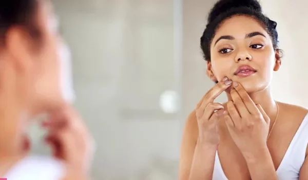 Το εγγυημένο hack μακιγιάζ που θα "σβήσει" στη στιγμή τα σπυράκια