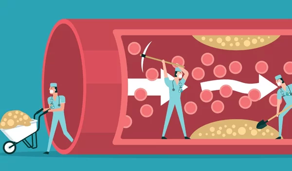 Οικογενής υπερχοληστερολαιμία: Τι είναι, τα συμπτώματα, η διάγνωση και η θεραπεία