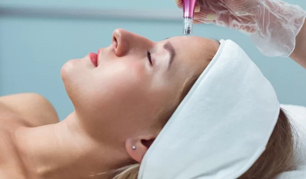 Microneedling με εξωσώματα: Τι προσφέρει στο δέρμα αυτή η επαναστατική θεραπεία;