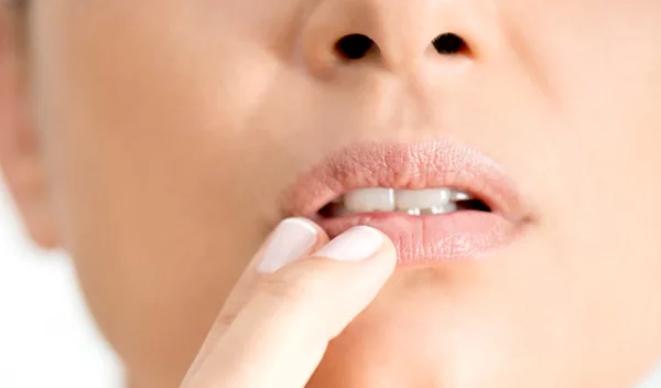 Πώς θα εξαφανίσεις τον επιχείλιο έρπη