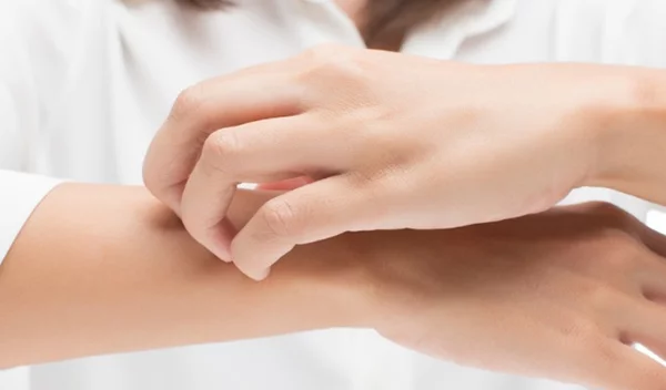 Ψωρίαση: "Μην παίζεις κρυφτό με το δέρμα σου"