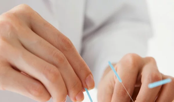 Αδυνάτισμα με βελονισμό: Πού ωφελεί, πώς εφαρμόζεται και πόσο κοστίζει;