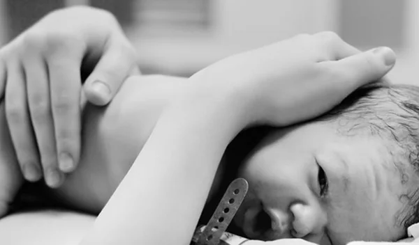 Καισαρική τομή: Σε ποιες περιπτώσεις είναι απαραίτητη;