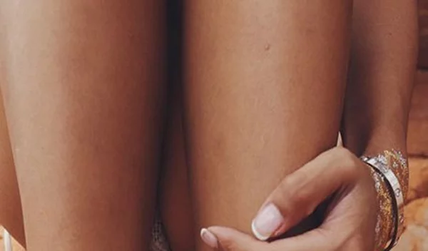 Μπορούν να εξαφανιστούν ανώδυνα οι κιρσοί;