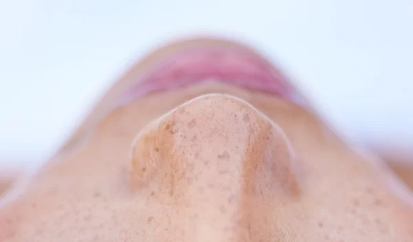 Μαύρα στίγματα στη μύτη; Δες πώς θα τα ξεφορτωθείς