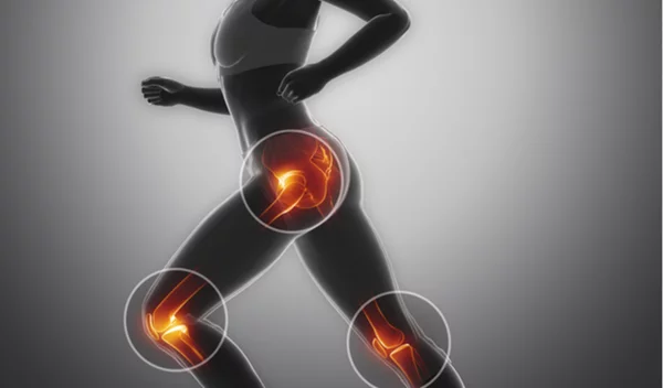 Πώς θα προλάβεις  την οστεοπόρωση; Ο ειδικός απαντά!