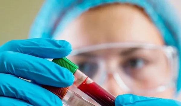 Αναπτύχθηκε νέο τεστ αίματος που ανιχνεύει τον καρκίνο!
