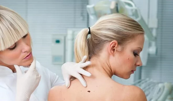 Δωρεάν δερματολογικός έλεγχος στο «Ερρίκος Ντυνάν» με αφορμή Ευρωπαϊκή Ημέρα Μελανώματος