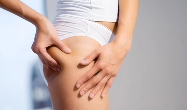 Οι δύο βασικοί λόγοι που έχεις κυτταρίτιδα και πώς θα την μειώσεις