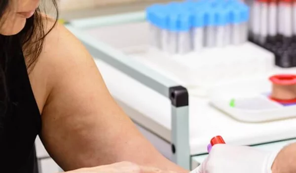 Έρχεται τεστ αίματος για τη διάγνωση του καρκίνου στο πάγκρεας