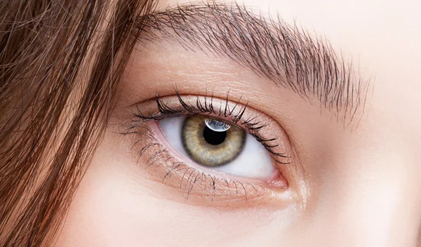 3 περίεργοι λόγοι που έχεις μαύρους κύκλους