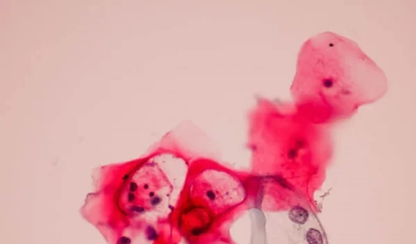 «Μην αργήσεις!» τον εμβολιασμό της κόρης σου για τον ιό HPV