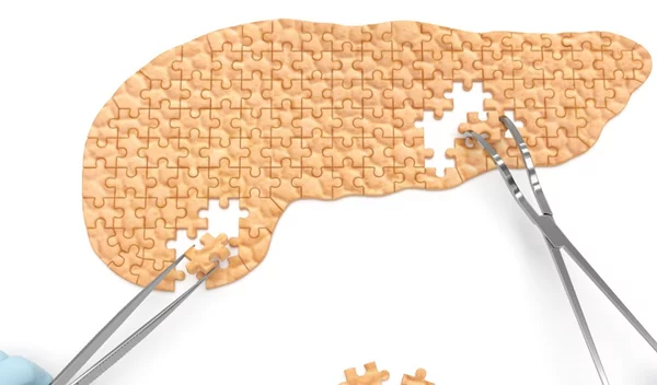 Καρκίνος στο πάγκρεας: Από την παθογένεση στη διάγνωση και τη θεραπεία