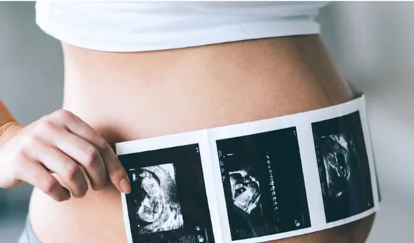 Εξωσωματική γονιμοποίηση: Τι είναι η Mini IVF και πότε προτείνεται;