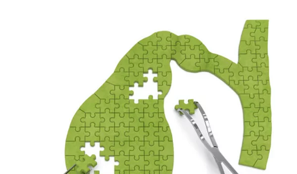 Πέτρα στη χολή και άλλα 4 πιθανά προβλήματα που πρέπει να γνωρίζεις