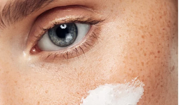 Το δέρμα σου όταν πιάσεις τα 30: Αυτά συστήνει η δερματολόγος τώρα