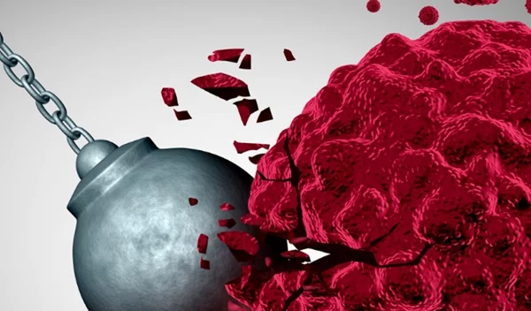 Τι έχει αλλάξει στην ανοσοθεραπεία για τον καρκίνο του μαστού;