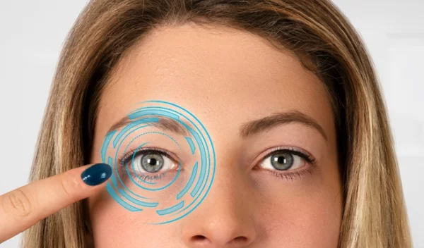 Είναι οι ενδοφακοί η λύση για την πρεσβυωπία;