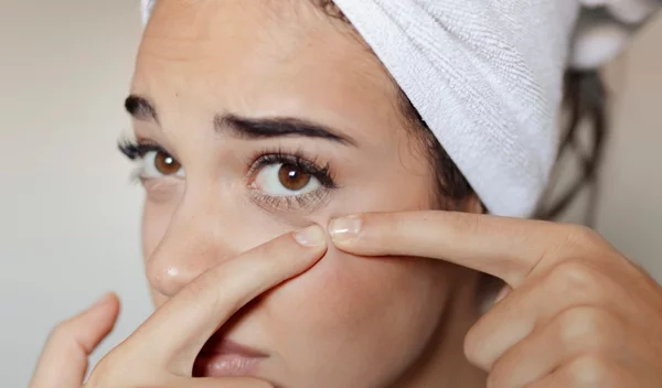 Κυστική ακμή: Ο πιο γρήγορος τρόπος να απαλλαγείς από τα επώδυνα σπυράκια