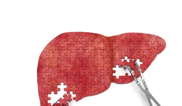 Καρκίνος του ήπατος: Τα συμπτώματα και οι παράγοντες κινδύνου (Spoiler: Το αλκοόλ και η παχυσαρκία είναι ανάμεσά τους!)