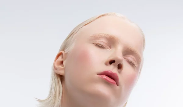 Τι είναι ο αλφισμός από τον οποίο πάσχει το μοντέλο Ανδριανή Ζαχάρη