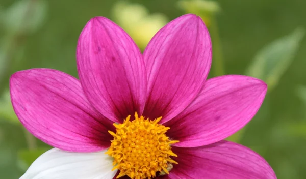 Νόσος Fabry: Τι είναι η γενετική πάθηση, τα συμπτώματα και ο ρόλος του οικογενειακού ιστορικού