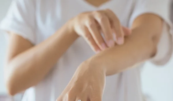 Έχεις ψωρίαση; Μάθε μια σημαντική παράμετρο για τη διαχείρισή της