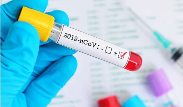 Κορονοϊός: Πέμπτος νεκρός στην Ελλάδα - Στα 387 έφτασαν τα κρούσματα