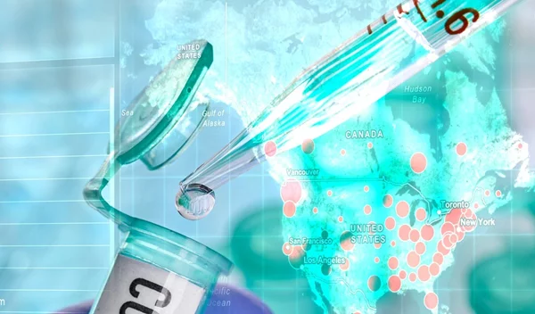 Πού βρισκόμαστε με το εμβόλιο και τη θεραπεία για τον κορονοϊό; Ο πρύτανης του ΕΚΠΑ Θάνος Δημόπουλος απαντά