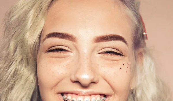 Σιδεράκια για ενήλικες: Τι προσφέρουν και τι επιλογές υπάρχουν